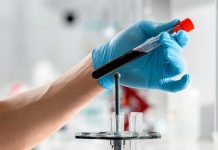 Várandósság alatti vérvételek: Milyen célt szolgálnak?