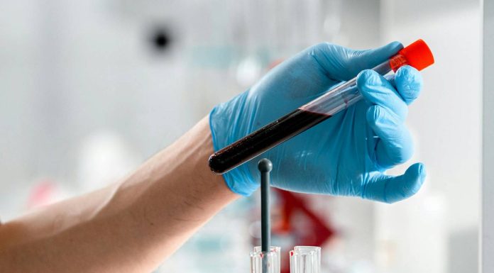 Várandósság alatti vérvételek: Milyen célt szolgálnak?