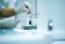 A test titkos nyelve: mit mesél egy csepp vér a vérvétel során